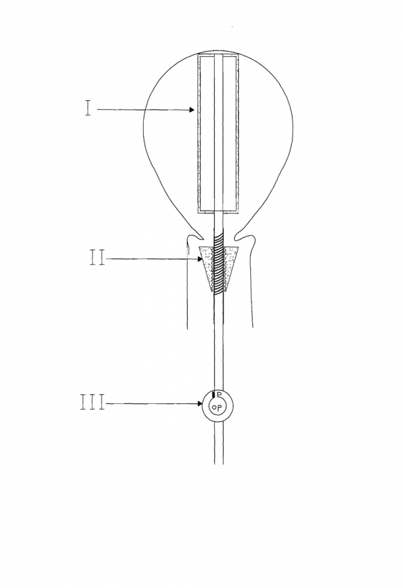 Incarceration of Gravid Uterus as a Content of Anterior Abdominal Wall Hernia Secondary to Diverification of Recti Dr. Bharati Sahu ? , Dr. Archana Thakur ? , Dr. Nazreen ? , Dr. Nupur ? & Dr. Monika ¥ I. Introduction