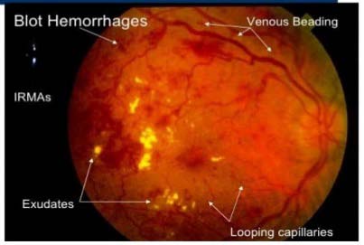Cytoprotective Effect of Biofield Energy Treated Test Item against Tert-Butyl Hydroperoxide (T-BHP) -Induced Cell Damage in Hepg2 Cell-Line