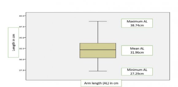 e. ???? = ???? ???? . The distance of the nerve from important bony landmarks such as the anterior and posterior edges of the acromion, and lateral epicondyle of the humerus were measured and recorded in structured data collection forms. Data were then entered into a Microsoft ® Excel ® database and exported to SPSS version 21 for Windows ® (SPSS, Chicago, IL, USA) for analysis.III.