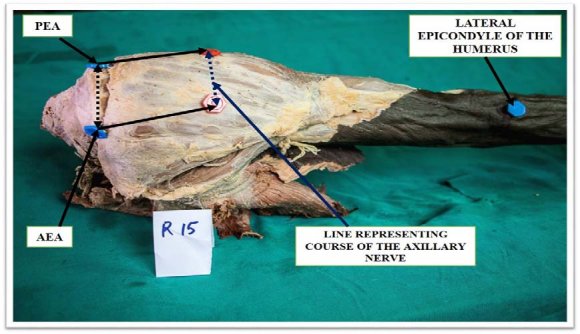 Figure 2: Average arm length (AL).