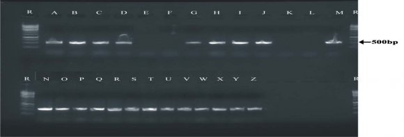 Group II -Received standard drug sodium picosulfate (positive control) 5mg/kg p.o. ? Group III -Aqueous extract of Trigonella foenumgraecum seed at a dose of 250 mg/kg body weight p. o. (Test -I) ? Group IV -Aqueous extract of Trigonella foenumgraecum seed at a dose of 500 mg/kg body weight p. o. (Test -II) i) Evaluation of laxative activity