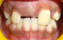 Figure 2: Showing histopathology picture of tissue taken