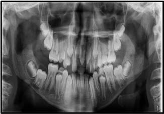Fig. 10: Primary closure