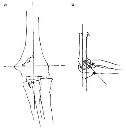 Figure 9: C/D Supination and pronation