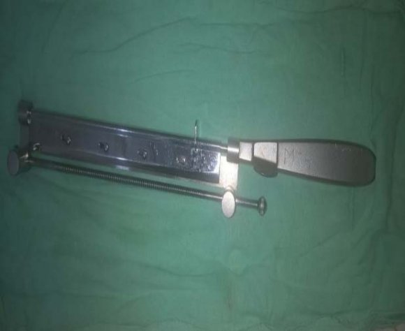 Figure 5: ManagementOverall, surgery was performed in 69.47% of all the patients the type of which depended on cause and intra-operative findings. The rest of the patients, 30.53%, were managed conservatively.j) ComplicationsOverall, 31 (37.80%) patients had complications while 51 (62.2%) had none. Complications were observed either pre-operatively or post-operatively as shown in the tables below. These did not occur in isolation since at least two could be found in one case.