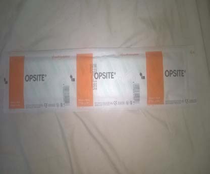 Figure 8: Mortality rate in percentageMortality/duration of symptomsThe mortality rate increased with increased duration of symptoms as shown in the tables below.