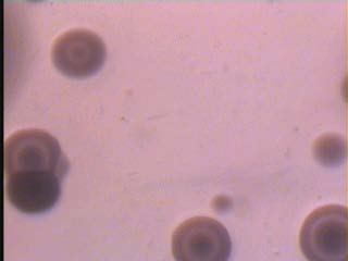 Figure 1: The fried egg colonies of M.hominis on modified PPLO medium (X 160)