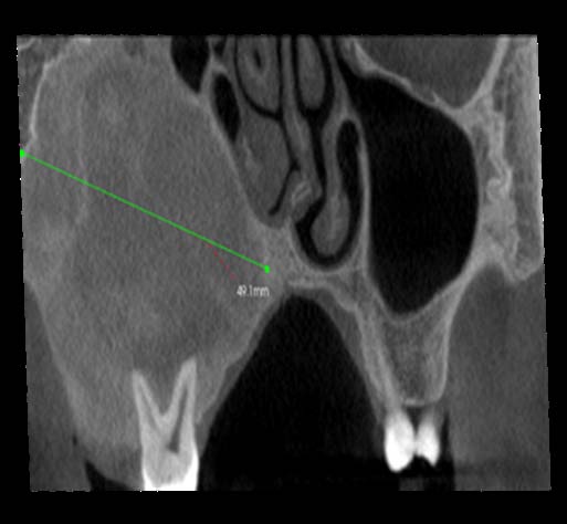 Figure 5: CBCT (axial view)