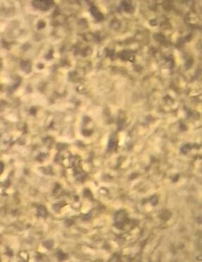 Figure 1: Comparison between GS alone and EPL with GS on the growth of Vero & MDBK cells.