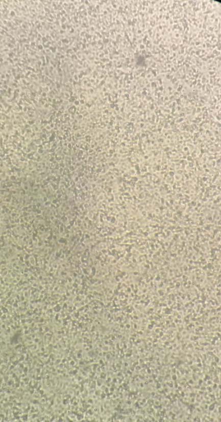 Figure 2: Multiple comparisons in the growth of Vero & MDBK cells using different Growth promoting factors at the same concentrations.