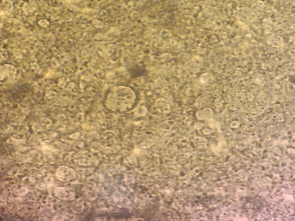 Alternatives to Fetal Bovine Serum in Different Cell Cultures