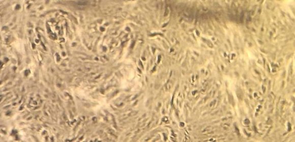 5% & (GS) in MDBK and Vero cells respectively. 2. (GS) % could be decreased when 0.5-1% Equine Platelet lysate (EPL) added to growth medium. 3. 7-10% newly born calf serum. 4. Up to 7 -10 % (EPL) alone Perspective not only economic view that produced in large amounts at relatively low cost but also hygienic serum-free medium for cell cultures to avoid the risk of transmitting bovine infections.