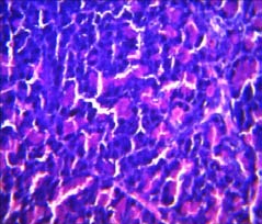 i) Histology of the pancreatic tissue Plate I to III demonstrates the histological changes in Pancreatic, Liver, and Kidney tissues of four (4) groups at the end of the experimental period. (A) Section of the pancreas from normal control, with no visible lesions, observed. (B) Section of the pancreas from negative control, with a severe peritubular cellular infiltration. (C) Section of the pancreas from positive control, with no visible lesions, observed. (D) Section of the pancreas from 15% Okara diet, with no visible lesions, observed. (E) Section of the liver from normal control, with no visible lesions, observed. (F) Section of the liver from negative control, with random foci of single-cell hepatocellular necrosis. There is moderate Kupffer cell hyperplasia. (G) Section of the liver from positive control and (H) Section of the liver from 15% okara supplemented diet showed no visible lesions. Fig I to L section of the kidney showed no visible lesions for all groups. Plate I: Showing the histological section of Pancreatic Tissue D Functional Dietary Supplementation of Okara (Soybeans Residue) on Streptozotocin Induced Diabetes Mellitus in Male Wistar Rats Showing the histological section of Liver Tissue Plate III: Showing the histological section of Kidney Tissue IV.