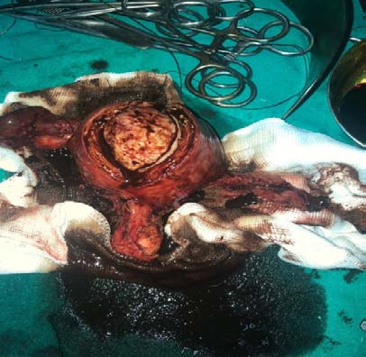 Fig. 2: Scatter Diagram of the Number of Neurons in the Cerebrum Cortex