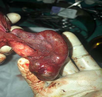 Mozart Compilation during Pregnancy Gave Higher Number of Neurons of Rattus Norvegicus Offsprings' Cerebrum Compared with Jazz, Blues, and Rock Compilations