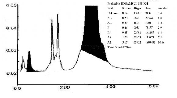 Figure 1: Comparison of incidences of HLA-B27 positivity between two groups. Author ? ?: Department of Pathology and Opthalmology, V.M.M.C & Safdarjung Hospital, Delhi, India. e-mail: dryadavindu@gmail.com