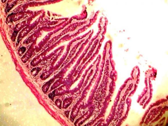 Normal control showed a mucosa layer with few intestinal goblet cells lined by epithelial cells and intact submucosa and smooth muscle layers. (H&E. X100). Administration of 100mg/kg/28days showed a mucosa layer with considerably increased intestinal goblet cells lined by epithelial cell and well-preserved submucosa and smooth muscle layers. (H&E. X100).