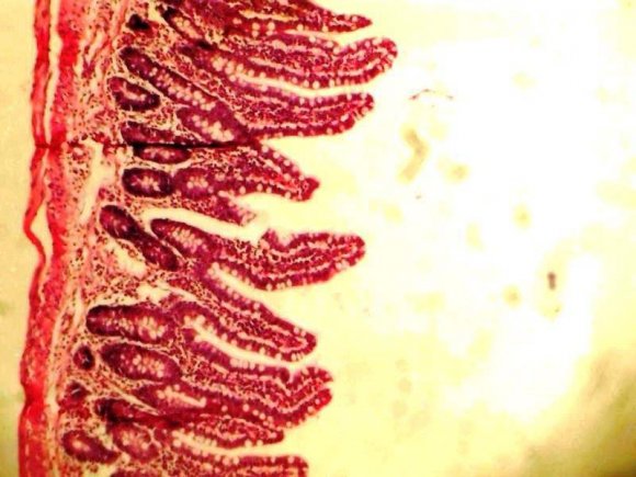 Administration of 400mg/kg/28days showed a mucosa layer with numerous intestinal goblet cells lined by epithelial cells, and well-preserved submucosa and smooth muscle layers H&E. X100).