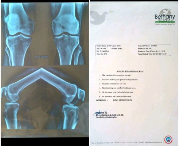 . When the patient wants to move his knee Year 2020