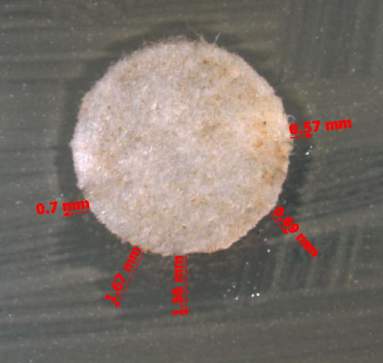 Figure 9: Results of methanolic seed extract inhibiting E. coli at different time intervals