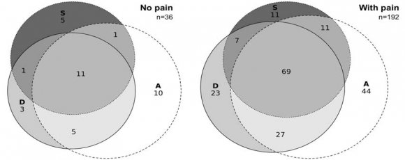 Indicators for evaluating the psychometric properties of the Depression, Anxiety and Stress Scale model (DASS-21) to the data of a sample of adult individuals without pain and with different temporal conditions of pain *?:standardized factor loadings; ?: standardized estimative SOHM; s 2 (D/A/S): explained variance of the factors Depression (D), Anxiety (A) and Stress (S); ? 2 /df: ratio of chi-square to degrees of freedom; CFI: comparative fit index; TLI: Tucker-Lewis index, RMSEA: root mean square error of approximation; CI: confidence interval; r: correlation between factors;AVE: average variance extracted; ?: ordinal alpha coefficient; CR: composite reliability. # SOHM: second-order hierarchical model.l.