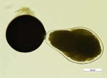 Figure 4: Optimized chromatogram of Sofosbuvir, Velpatasvir, and Voxilaprevir