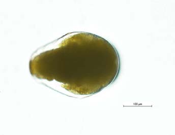 Figure 5: Blank chromatogram