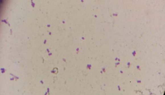 Figure 2: Ruminococcus spp x 100