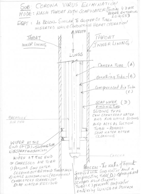 Fig. 1: Bone marrow aspirate showing cytoplasmic vacuolization of the erythroid (blue arrows) and myeloid lineages (red arrows), Original magnification 1000x