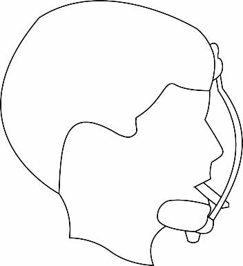 Figure 1: A depiction of circummaxillary sutures