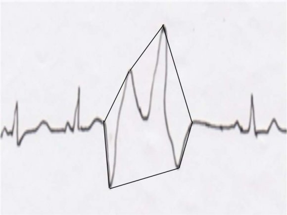 Figure 2: Absolute (actual) No. of MD before adjustment per region (N=1,744)