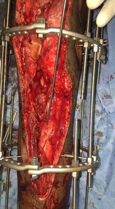 Fig. 18: Postoperative 12 months clinical images.