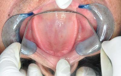 Figure-4: Close view of the figure-3 case.