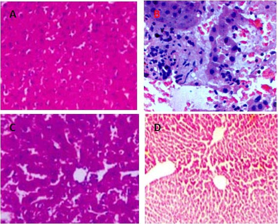 Serum AST in prospective groups at baseline and after three months of treatment. value represents the mean ± standard error of mean. * P ? 0.05 significant difference from baseline and values. a P ? 0.05 significant difference from healthy subjects values. b P ? 0.05 significant difference from healthy subjects values.Table 10 : Serum ALP in retrospective groups at baseline and after three months of treatment. 98.27 ± 12.67*a 81.06 ± 7.25 b 20 Combination therapyEach value represents the mean ± standard error of mean. * P ? 0.05 significant difference from baseline and values. a P ? 0.05 significant difference from healthy subjects values. b P ? 0.05 significant difference from healthy subjects values.