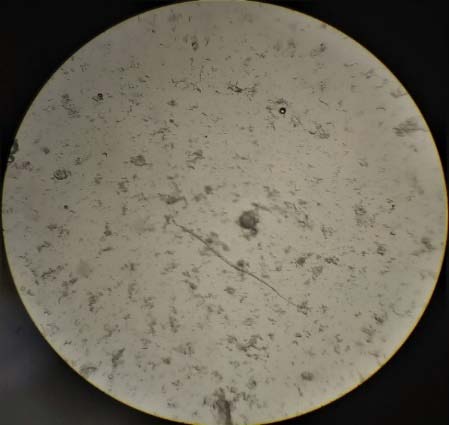 Figure 2: Schematic representation of preparation of proniosomes