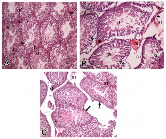FIG. 1: (A) Photomicrograph of transverse section of testis of a control rat, showing the different stages of spermatogenic cells (G) the seminiferous tubules with thin normal basement membrane (arrow), and the interstitial cells (ST). (H&E X 250). (B) Photomicrograph of transverse section of testis of the treated group with alumimium chloride, showing marked degeneration and necrosis of germ cells (G) lining of the seminiferous tubules with thick basement membrane (arrows), and fragments of germ cells (Fr) within the lumen of seminiferous tubules. There are also edema of interstitial cells (IC), and congestion of interstitial blood vessel (IB). (H&E X 250). (C) Photomicrograph of transverse section of testis of the treated group with alumimium chloride, and propolis, showing nearly normal histological pattern in the germ cells (G) lining the seminiferous tubules with normal basement membrane of that tubules (arrows), as well as normal interstitial cells of Leydig (ST) and no congestion of interstitial blood vessels (IB). (H&E X250)