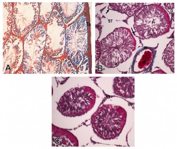FIG. 3: (A) A photomicrograph of a transverse section of a control rat testis showing normal thickness of the basement membrane (bm) (PAS X250) (B) Photomicrograph of transverse section of testis of the treated group with alumimium chloride, showing a decreased in PAS reaction in the markedly degenerated germ cells (G) lining the seminiferous tubules , as well as decreased PAS reaction of the interstitial cells (ST), (PAS X 250) (C) Photomicrograph of transverse section of testis of the group treated with alumimium chloride, and propolis, showing marked increase in PAS reaction of the seminiferous tubules components including the germ cells (G), and also increase in PAS reaction of interstitial cells of Leydig (ST).(PAS x 250).
