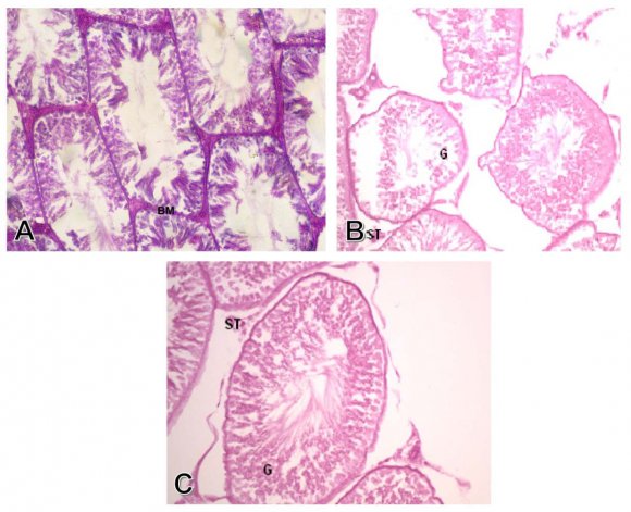FIG 4: (A1) Photo electron micrograph of the testis of a control rat, showing basement tubular membrane (Bm) A and B types spermatogonia (St), nuclei (N), mitochondria (m) .(X120000). (A2) Photo electron micrograph of control rat testis, showing spermatid (ST) and its nucleus (N), mitochondria (M) and Golgi apparatus (G).(X12000). (B1) Photo electron micrograph of testis group treated with aluminum chloride , showing dilated irregular tubular membrane (Bm),Sertoli cell (S) , spermatogonia(SG) and early spermatid (ST), and vaculated cytoplasm (V) , irregular nuclei (N), swollen mitochondria (M), Golgi apparatus (GA), lipid (L).(X12000). (B2) Photo electron micrographs of rat testis group treated with aluminum chloride, showing degenerative and atrophy of spermatid cells (ST), degenerative nuclei(N), and defects in acrosomal cap formation, degenerated mitochondria (M), dilated endoplasmic reticulum (ER) and cytoplasmic vacuoles (V). (X18000). (C) Photo electron micrograph of rat testis, group treated with aluminum chloride and propolis showing nearly normal spermatid (ST) and secondary spermatocyte (S). (X12000).