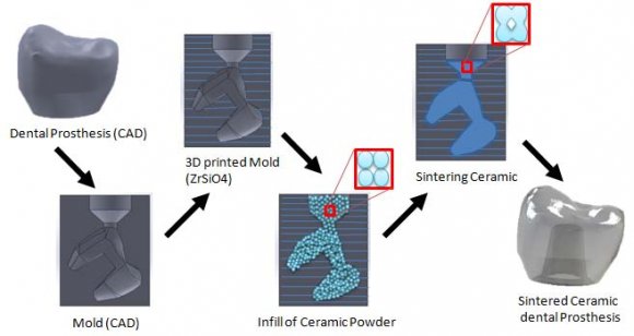 Figure 1: Schematic of ceramic dental prostheses based on ZrSiO4 -Glass composites fabricated by indirect Additive manufacturing