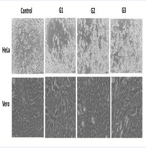 Figure 4: Morphology of HeLa and Vero treated with G1, G2 and G3 of R. junceus scorpion venom. A representative image of the effect of G1, G2 and G3 of R. junceus scorpion venom at 1 mg/mL on the treated monolayer for 72 hours. Cell controls showed 100% of viability. The images were captured using the DP-72 camera (Olympus Corporation, Tokyo, Japan). The experiments were performed in triplicate and repeated 3 times.IV.