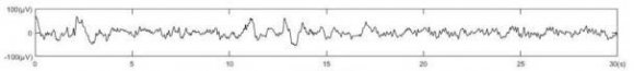 Figure 2: Optical Particle sizer.