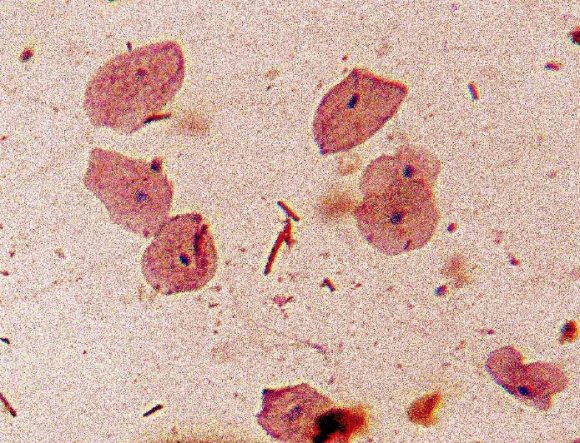 Figure 1: Gender distribution of participants Figure 2: Frequency of Participants from