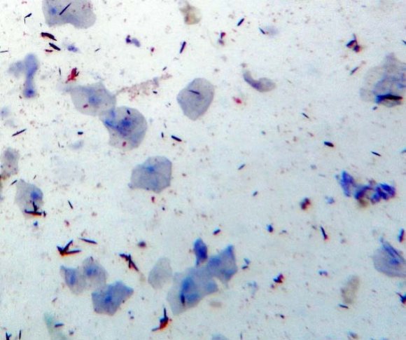 Fig. 3: Copper vessel water consumed once a day