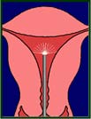 Maternal Well-Being during Pregnancy after One and Three Months from Delivery IX.