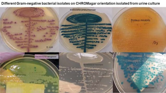 Figure 1: Growth of Uropathogens isolated from urine culture on CHROMagar orientation media Comparison between CHROMagar Orientation media, CLED agar VITEK 2-XL and MALDI-TOF used for the identification of uropathogens: Patterns of 587 culturepositive samples yielded different bacterial isolates including 491 single and 96 (two bacteria in each plate account for polymicrobial growths from urine culture shown in Table1 and Table2respectively.For presumptive identification of bacterial species by colony characteristics on primary culture of 491 bacterial and yeast isolates, 491(100%), 488(99.4%), 484 (98.5%) and 388(79%) could be differentially identified on MALDI-TOF, Vitek2-XL,CHROMagar Orientation and CLED agar respectively. The rate of presumptive identification of the isolates was found significantly higher on CHROMagar Orientation agar than CLED agar as primary urine culture medium (Table1; Figure2). E. coli was the leading bacteria isolated from 171 (34.8%) samples followed by Klebseilla pneumoniae 89 (18.1%), Enterococcus spp. 73 (14.8%), Pseudomonas aeruginosa 54 (10.9%), Acinetobacter spp. 21 (4.3%), Staph.aureus 16 (3.3%), Proteus mirabilis 13 (2.6%), Candida spp. 13 (2.6%), Enterobacter spp. 9 (1.8%), Staph. saprophyticus 11 (2.2%), and Streptococcus agalactiae 6 (1.2%) respectively.Presumptive identification of mostly gramnegative and gram-positive common uropathogens such as E.coli, K.pneumoniae, Proteus, Pseudomonas, Morganella morganii, and Enterococci spp. was correct on the CHROMagar media. E. coli was correctly identify in 99 to 100% of the cases. 4-5 of total 54 isolates of Pseudomonas aeruginosa were not correctly presumptively identify on the CLED media. Six of Citrobacter spp., 9 of Enterobacter spp. isolates presumptively misidentified as E. coli on the CLED agars. The colony appearance of Serratia on the