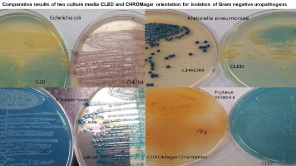 Comparison of CHROMagar Orientation versus CLED (cystine-lactose-electrolyte-deficient) Agar, VITEK-XL and MALDI-TOF in a Tertiary Laboratory Setting Processing Urine Culture Samples at Dr. Lal Path Labs, Delhi species may generate colonies with different colors and may not easily differentiate on conventional agars. Enterococci spp. and S.aureus presumptively identified (Figure3) on the CHROMagar and were not in CLED agar.