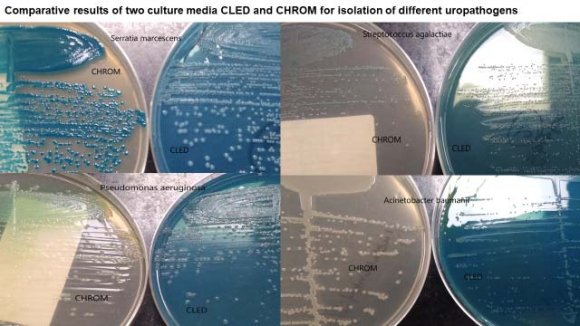 Figure 3: Comparison between CLED and CHROMagar Orientation media used for the isolation of polymicrobial uropathogens