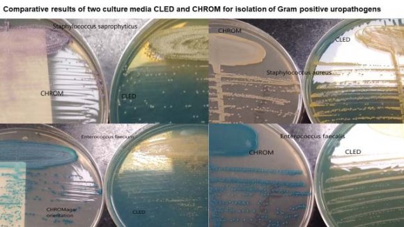 Figure 4: Comparison of incubation period culture media for the Rate of presumptive isolation as Primary culture plate of uropathogens IV.
