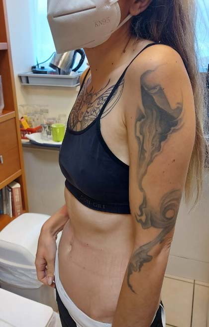 Environmental Exposure to Glyphosate and Risk of Asthma in an Ecological Study