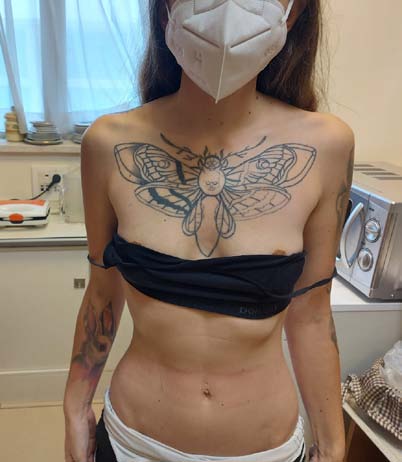 Figures 1-4: Images from our patient's extensive tattoos.